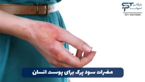 عوارض و مضرات سود پرک 5 مضرات سود پرک برای پوست انسان