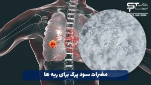 عوارض و مضرات سود پرک 4 مضرات سود پرک برای ریه ها