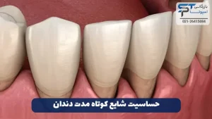 سفید کردن دندان با هیدروژن پراکسید 5 حساسیت شایع، اما کوتاه مدت دندان ها در استفاده از هیدروژن پراکسید - بازرگانی اسپوتا